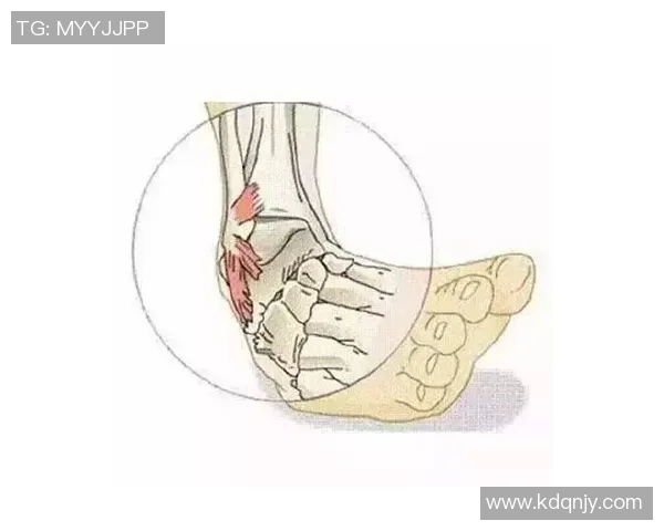 打篮球崴脚是常见伤害如何有效预防与处理以免影响运动生涯